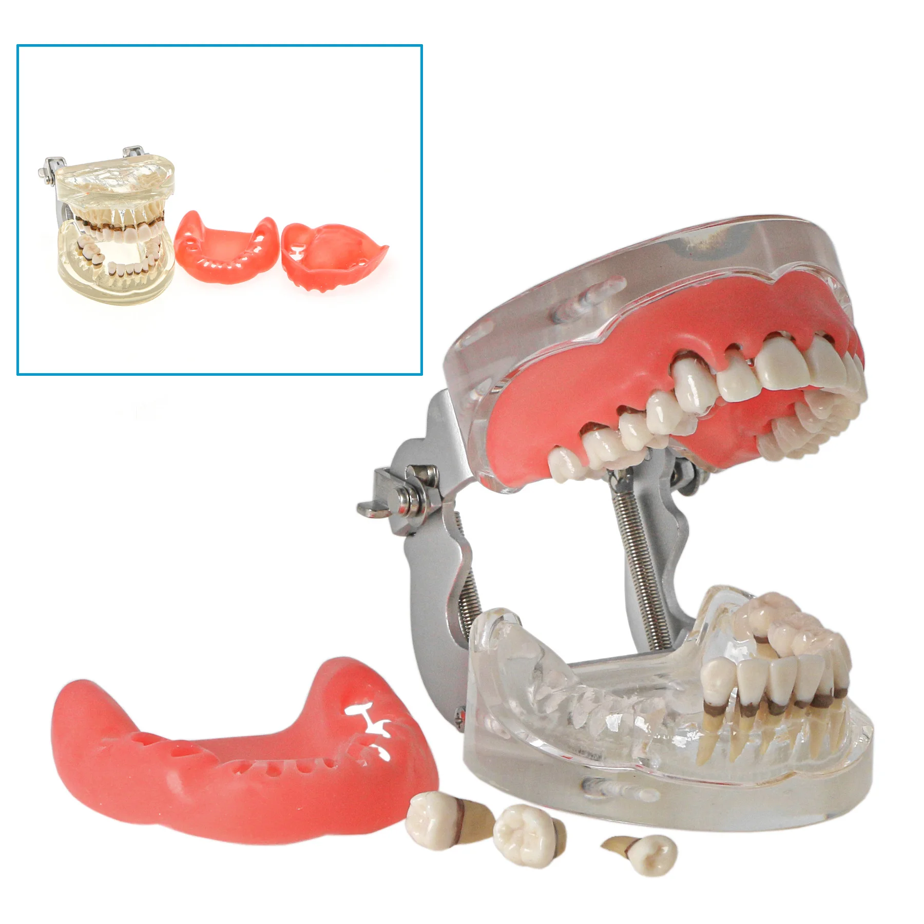 Рисунок 2 - M4017 Модель зубов патологической