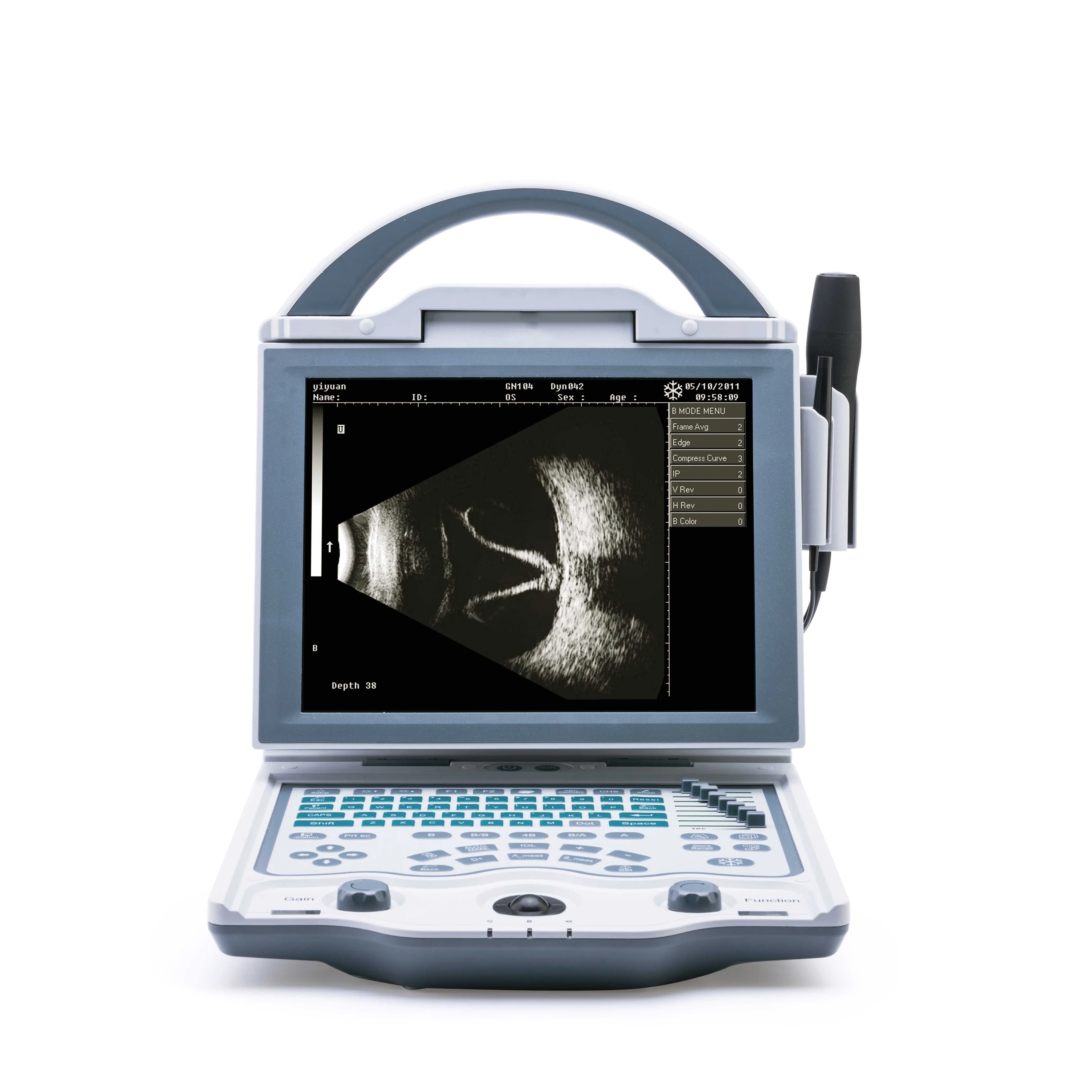 High Quality 10.4 Inch LED Screen Ophthalmic Ultrasound A/b Scan Low Price