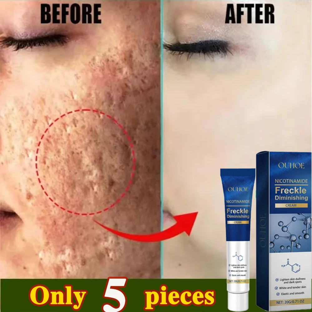 

Dark Spot Corrector Skin Whitening Fade Cream Lightening Blemish Removal Serum Reduces Age Spots Freckles Face Cream 20g