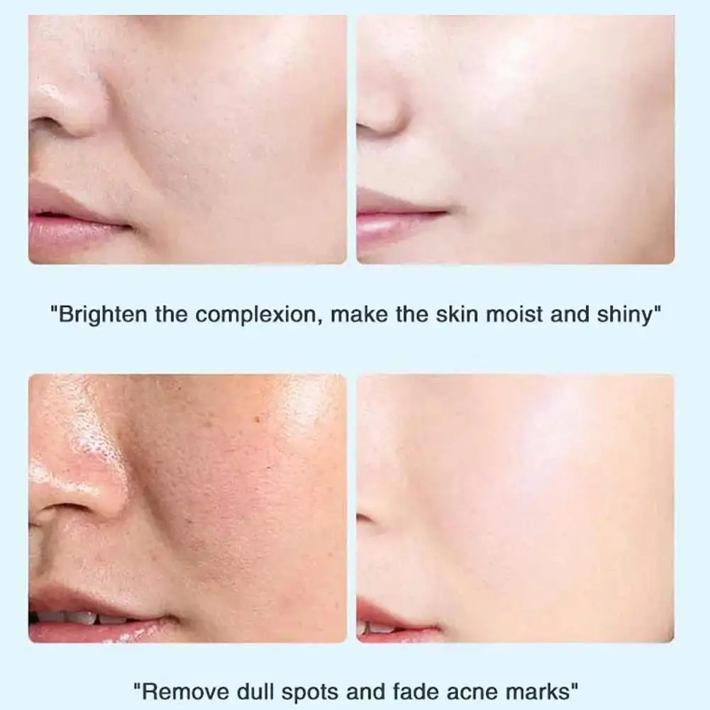 Whitening Cream For Face Spots Remove Dark Spot Melasma Anti-Pigmentation Improve Dullness Brighten Face Skin Care Cream