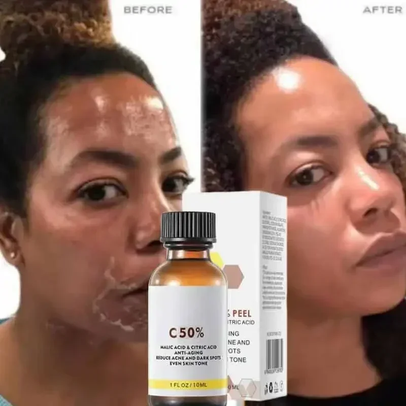 Óleo Peeling Esfoliante para Facial, Hidratante, Clareamento, Nutritivo, Reparação, Creme Facial, Cuidados com a Pele Beleza