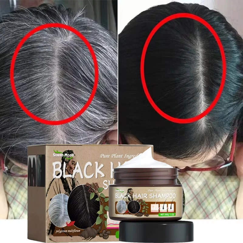 Natural Gray White Hair Treatment Shampoo White To Black Anti Gray Hair Dye Anti Loss Nourish Hair Care Products for Men Women