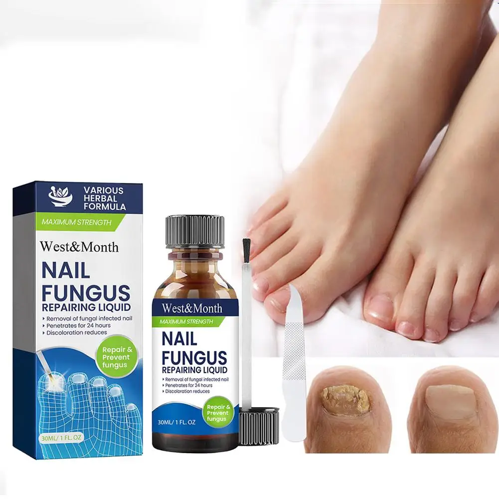 Trattamento Fungine Delle Unghie Piedi Cura Essenza Unghie Piede Paronichia Oli Per Unghie Fungo Anti Infezione Rimozione Onicomicosi Riparazione F7X0