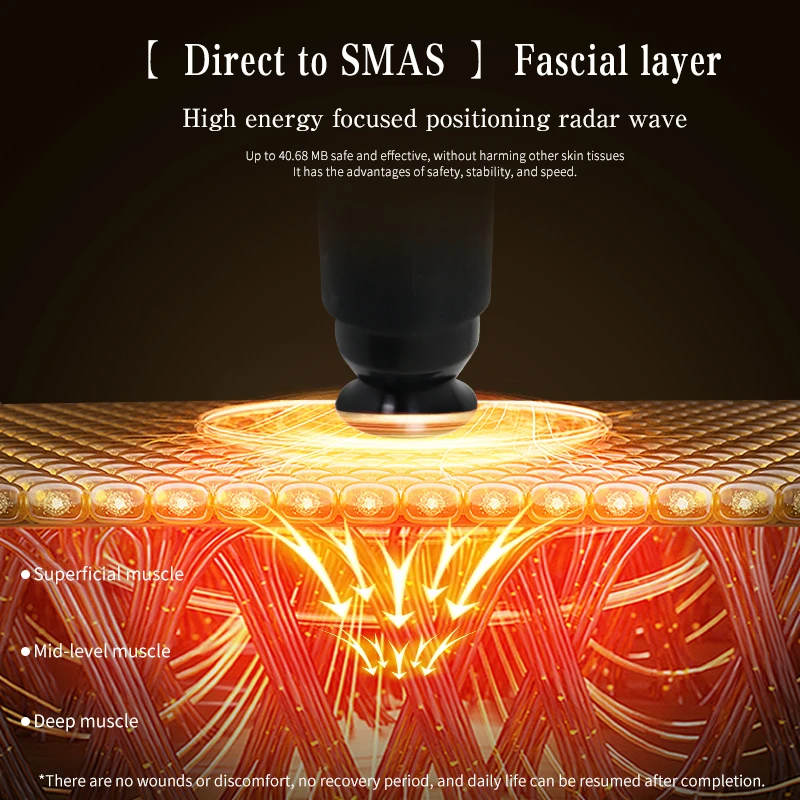 Ice Sculpture Master RF Facial - огляд і ціна Master Nutrition & Fitness Club Kuchaman City Reviews