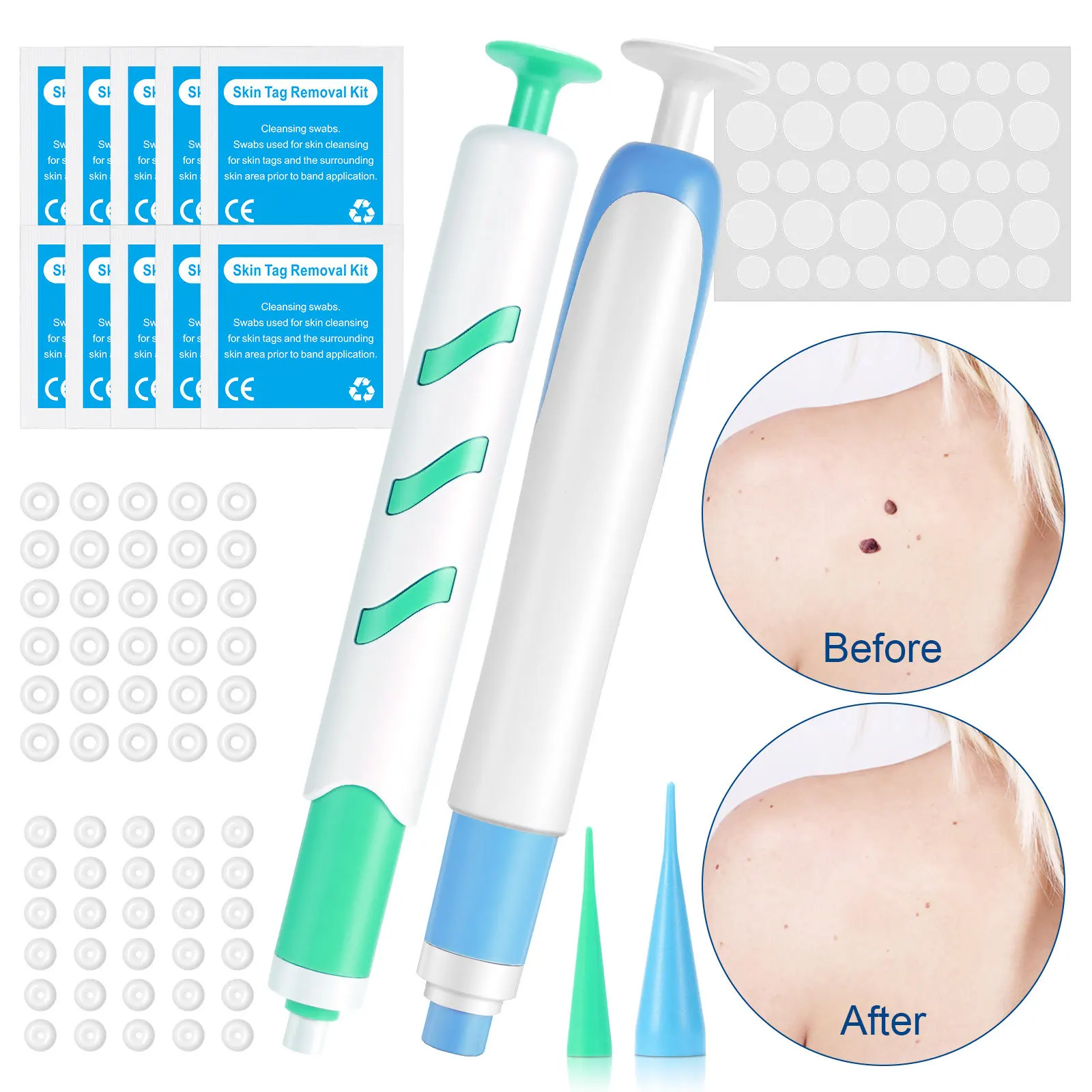 Kit de eliminación automática de etiquetas de piel 2 en 1 para etiquetas de piel pequeñas y grandes, 1-9mm con hisopos de limpieza, herramienta de cuidado de la piel facial para uso doméstico