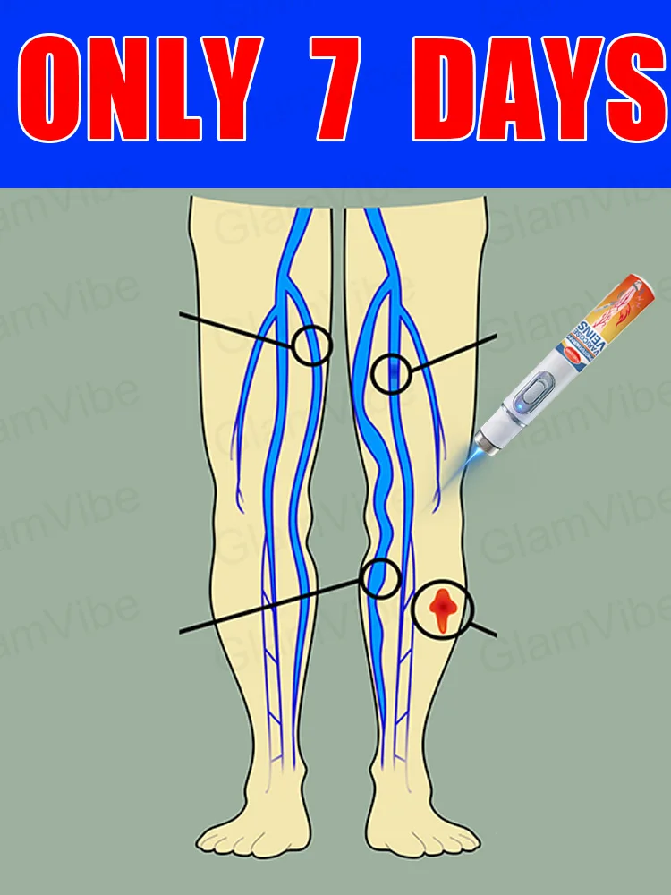 

blue light pen solve varicose veins, hot sale leg care tools