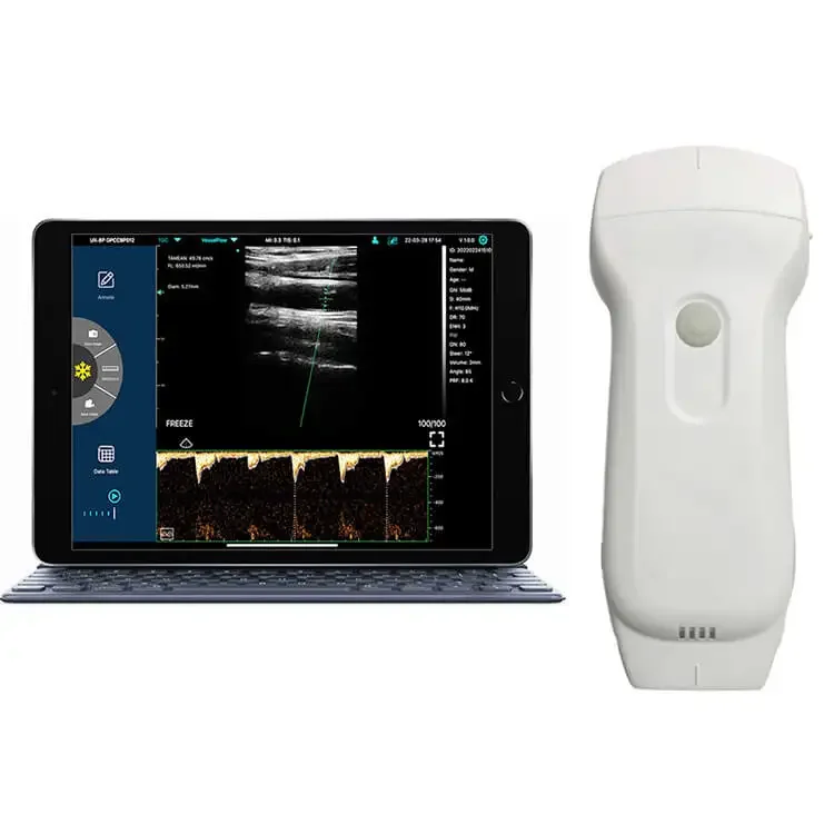 

Medical Vet Ultrasound Machine Portable Ultrasound Scanner