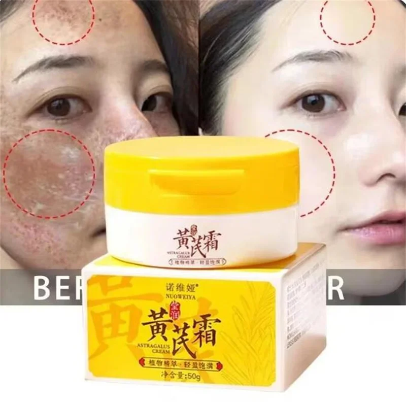 

Astragalus Whitening Freckles Cream Face Dark Spots Remover Repair Products Removal Melasma Melanin Moisturiz Brighten Skin Care