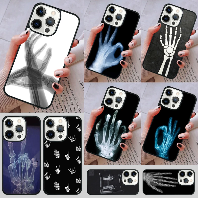 X-ray Hand Bones Phone Case cover For iPhone 14 13 15 16 Pro Max Coque 12 11 Pro Max For Apple 8 PLUS 7 6S fundas