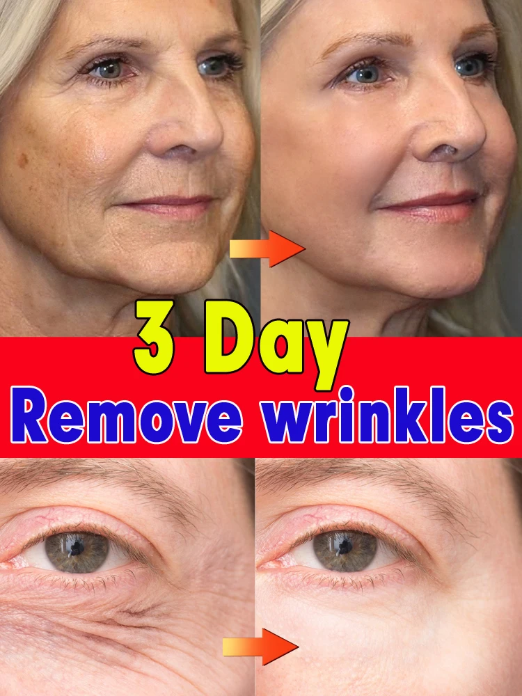 

Anti-wrinkle facial serum remove facial eye wrinkles anti aging