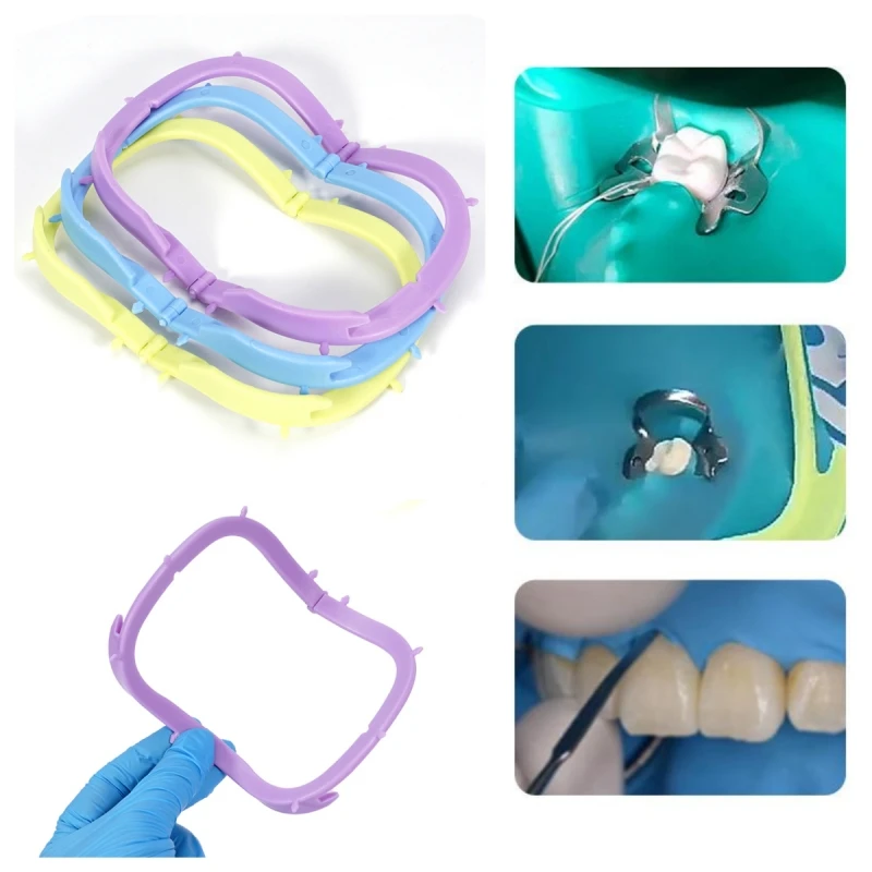 

Складной держатель для резиновых даммарок с пластиковым каркасом, инструменты для защиты полости рта