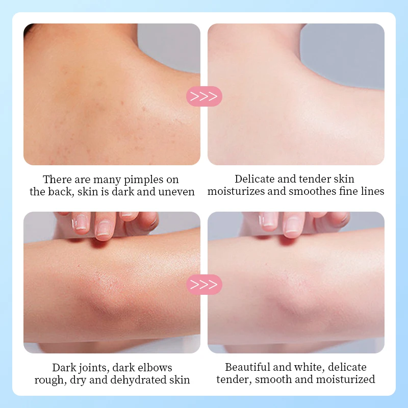 保湿アボカドボディクリーム マンゴーローズボディバター 柔軟化ボディケラチン ハイローション 保湿 P4U4