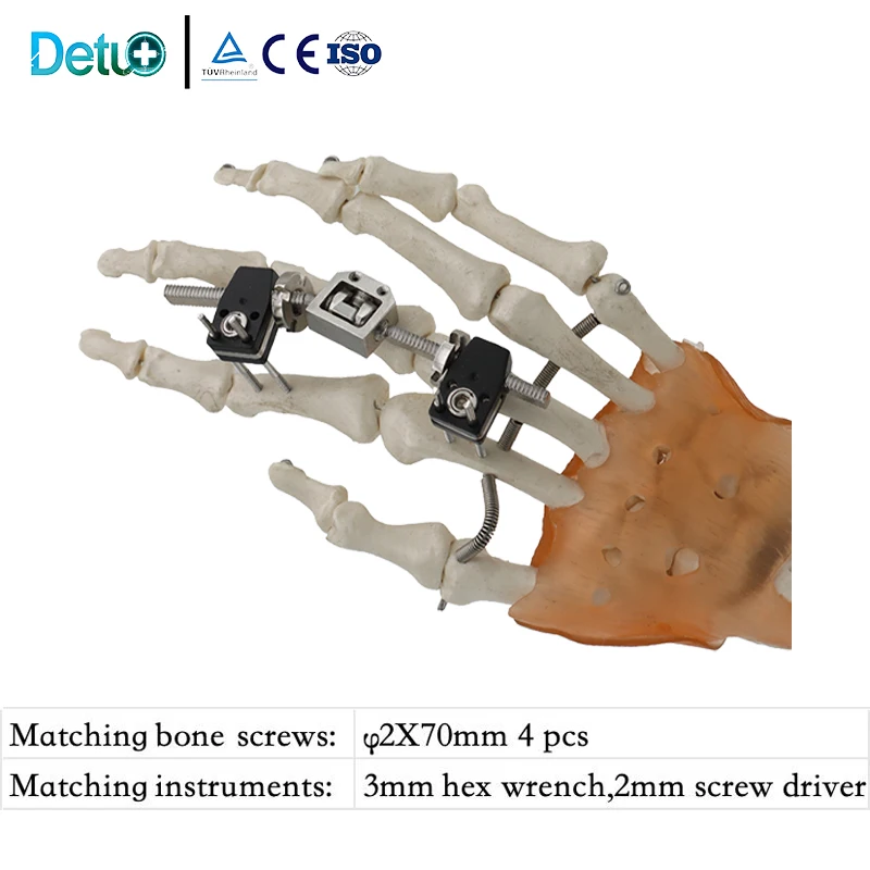 Orthopedic External Fixator, Metacarpal Phalangeal Trans Articular Type ,Mini External Fixator Series
