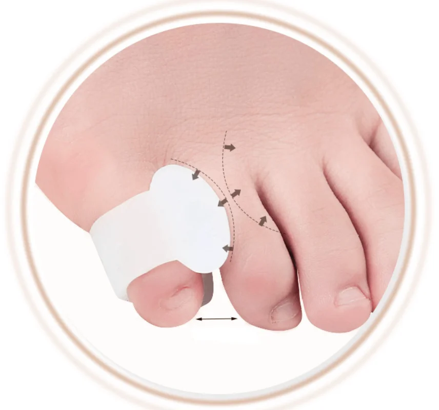 

35Pairs Bunion Corrector Hallux Valgus Gel Hammer Toe Protector Separators Finger Foot Pain Relief Care Tools Silicone Orthosis