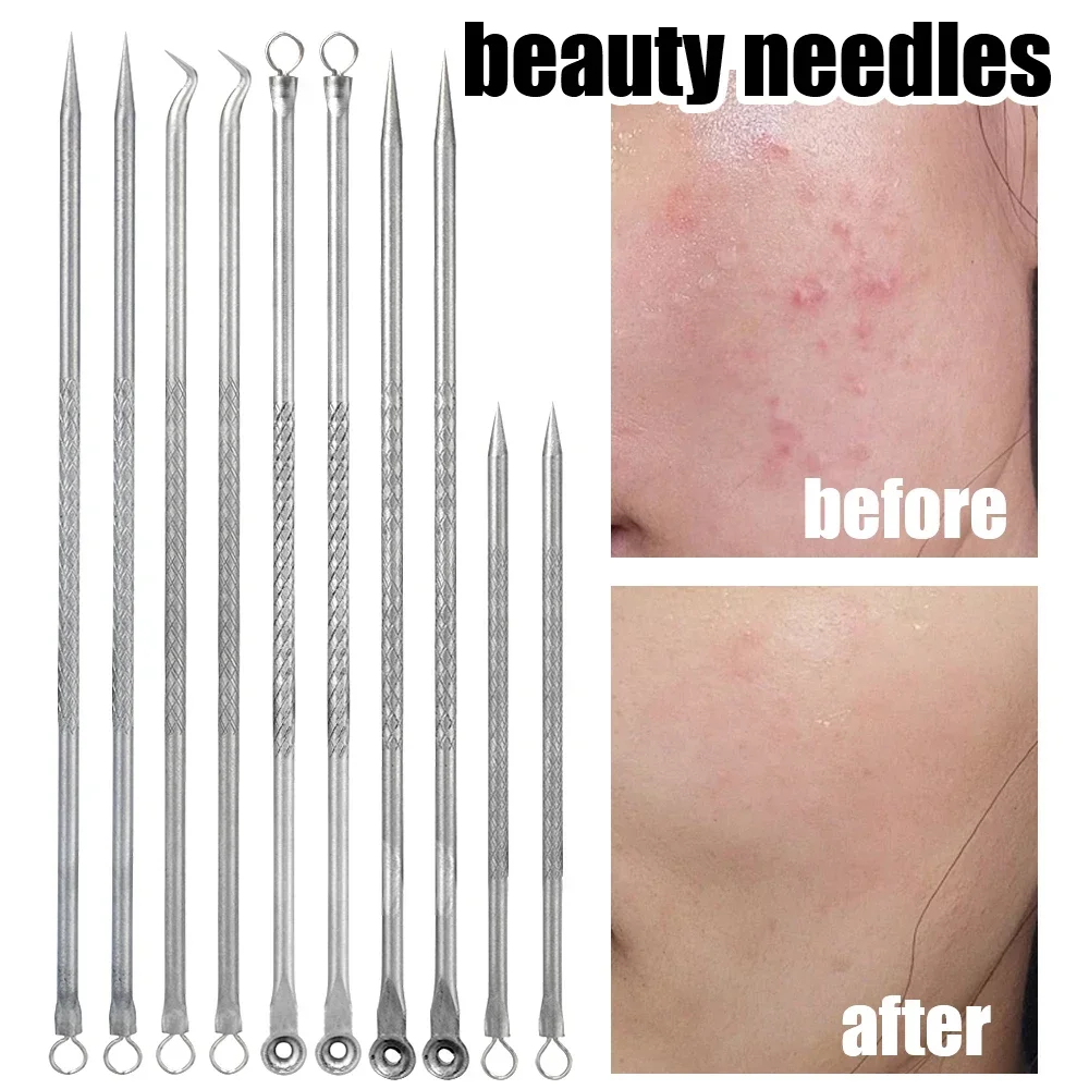 5Pcs Stainless Steel Acne Needle Set Blemish Pimple Squeezing Extractor Professional Tools Spot Cleansing Skin Care Beauty Tools