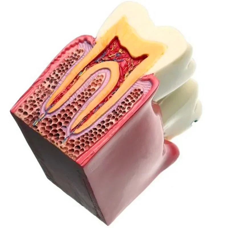 

Dental Materials Lab Teeth Model 6 Times Caries Comparation Study Models