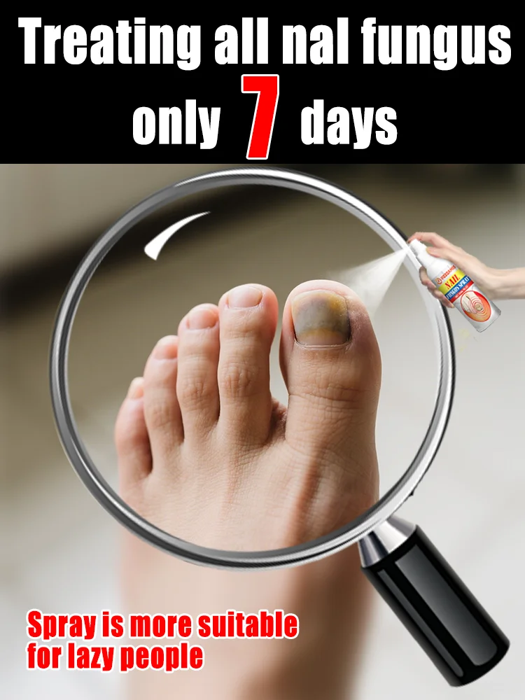 

The most powerful black technology in 2025,ᵉᶠᶠᵉᶜᵗⁱᵛᵉ ⁿᵃⁱˡ ᶠᵘⁿᵍᵘˢ ᵗʳᵉᵃᵗᵐᵉⁿᵗ⸴ ʳᵉˢᵗᵒʳᵉ ⁿᵃⁱˡ