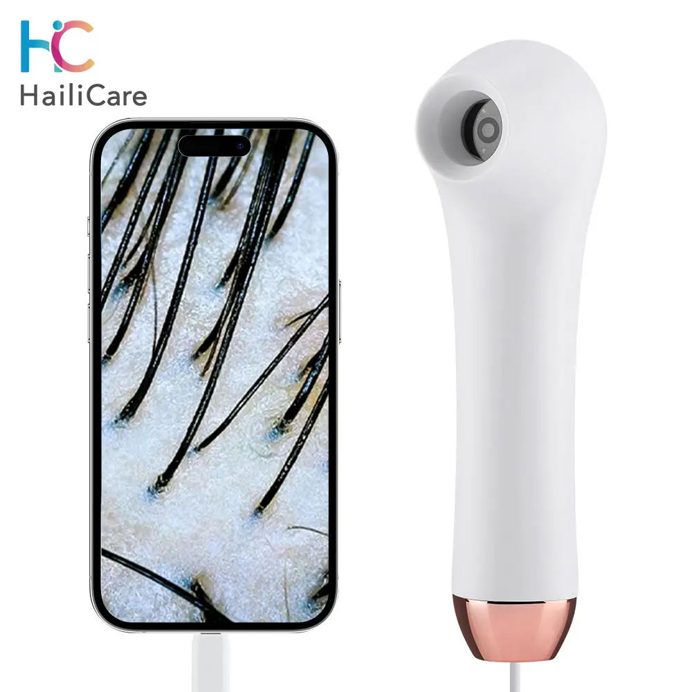 New Visual Digital HD Dermatoscope Hair Follicle Scalp Detector Pores Magnifier Facial Skin Hair Analyzer Machine Beauty Device