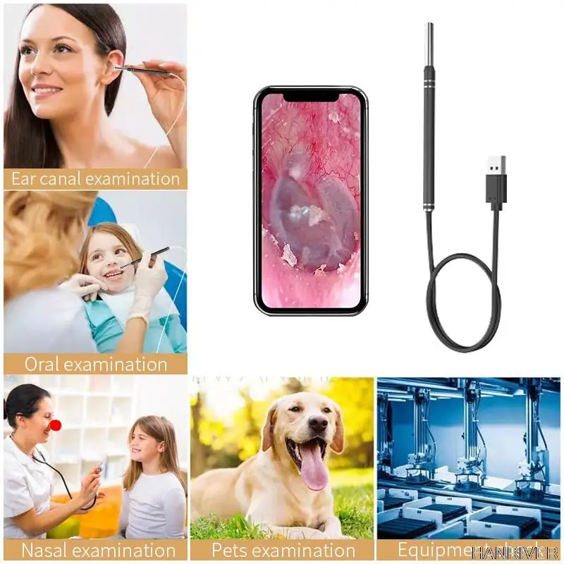Ear Artifact 5.5mm Visual Ear Spoon Endoscope Intelligent Visual Ear Spoon Otoscope Ear Canal Ear Picking Stick