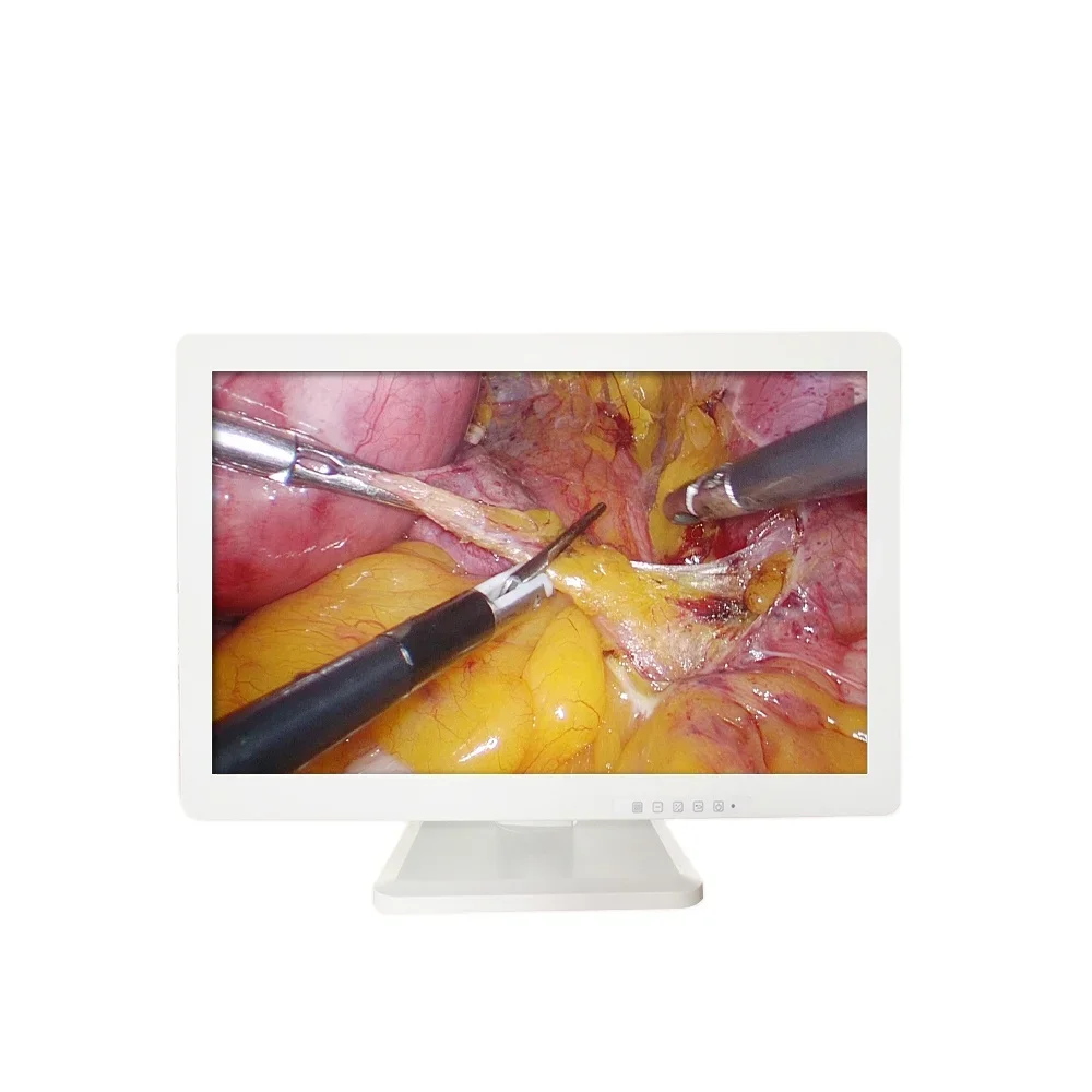 High quality cheap 27 inch medical hd endoscopy  for