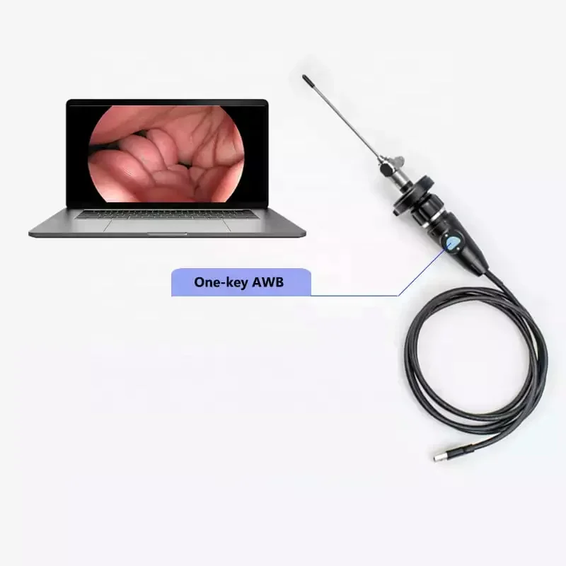 USB3.0 1080P Full HD Medical Portable Endoscopic High Resolution CMOS endoscop camer for ENT Laparoscope Gynecology