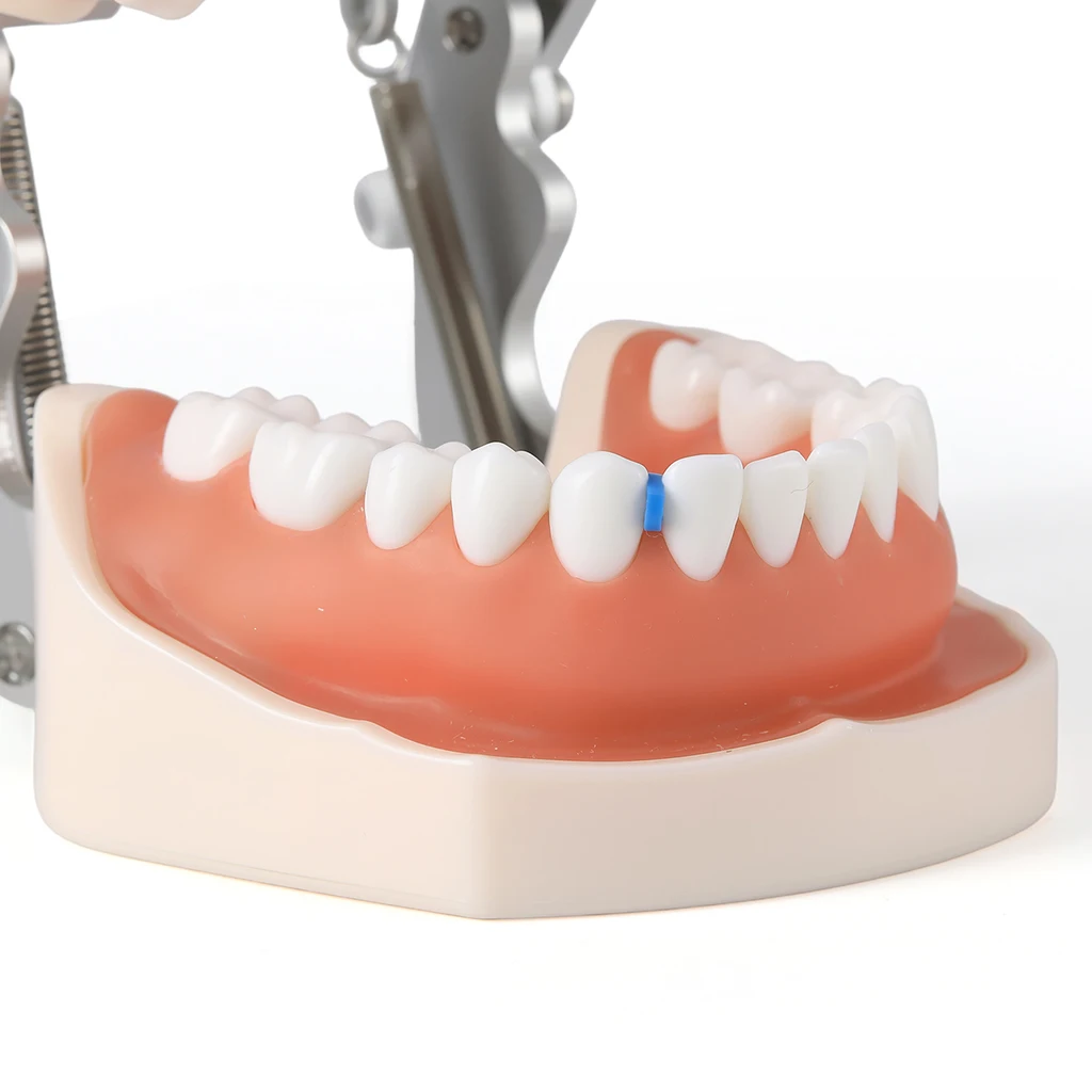 1000 Stück/Packung AZDENT Dental Kieferorthopädische Separatorbänder Elastische Gummibänder Zahnmedizinisches Material zur Erweiterung des Zahnraums – Detail 9