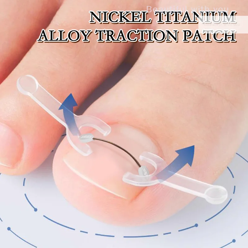 

Ingrown Toenail Correction Tool Ingrown Toe Nail Treatment Elastic Patch Sticker Straightening Clip Brace Pedicure Tool