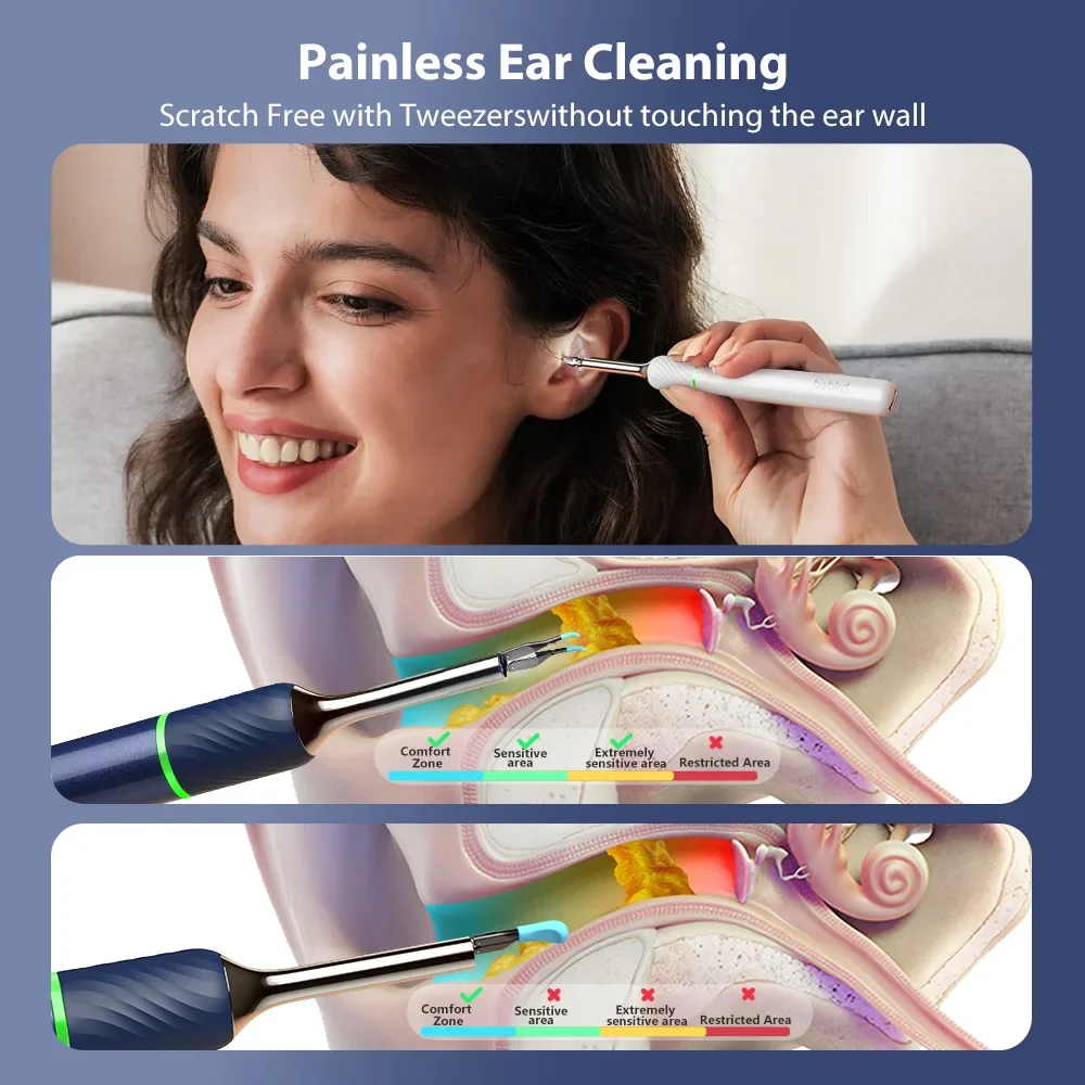 Bebird Note5 Pro الأجهزة المنزلية الذكية إزالة شمع الأذن المرئي منظف الأذن الناعم والمريح