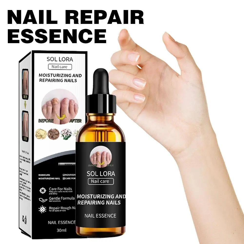 30ml Nail Fungus Treatment Serum Essence Oil Care Repair Feet Anti Nails Removal Toe Essence Cream Infection Gel P4y9