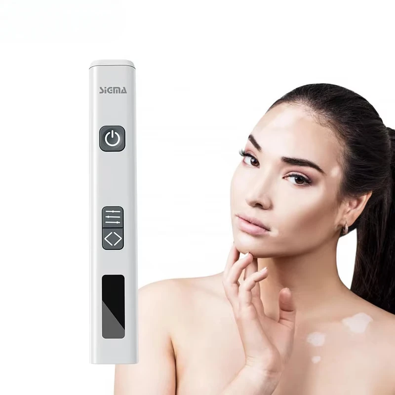 

mini 308nm uvb device hand foot vitiligo treatment equipment 33mW