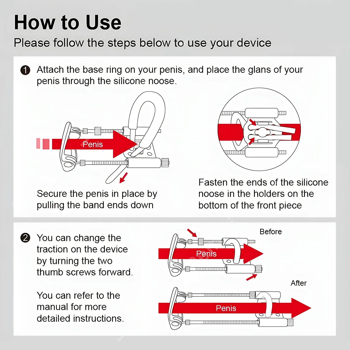 Penis Extender Adjustable Penis Stretcher Kit Penis Enlargement Traction Device Penis Enlarger Sex Toys for Men Penis Trainer