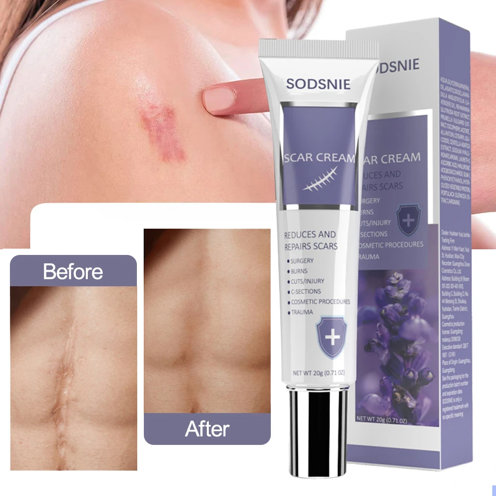 20g Scar Cream Skin Repair Scars Treatment Smooth Whitening Effective Remove Burn Stretch Marks Acne Spots Body Care Product