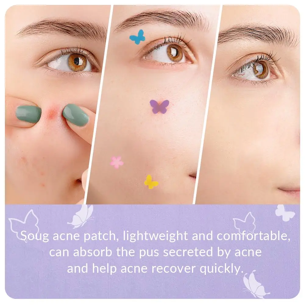 120Pcs Butterfly Shape Acne Pimple Patch Stickers Blemish Spot Concealer Cover 0.1mm Acne Treatment Pimple Remover Skin Care
