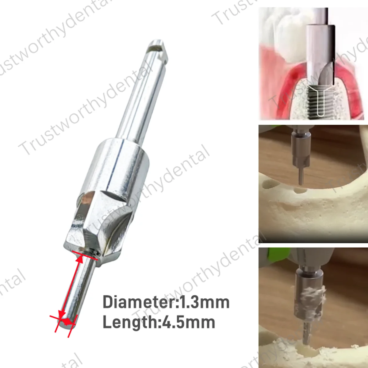 Dental Countersunk Drills Smooth Ridge Trimmer Drills Abutment Bone Remove Tools