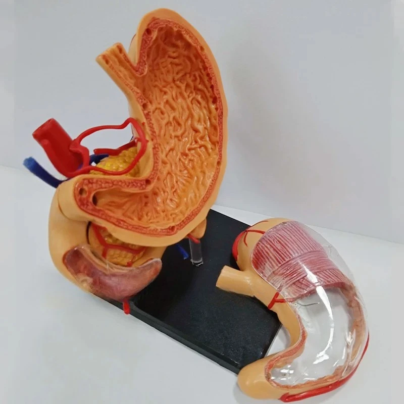Stomach Model, Human Organ Model, Stomach Assembly, Anatomical Model, Stomach Structure, Educational Model
