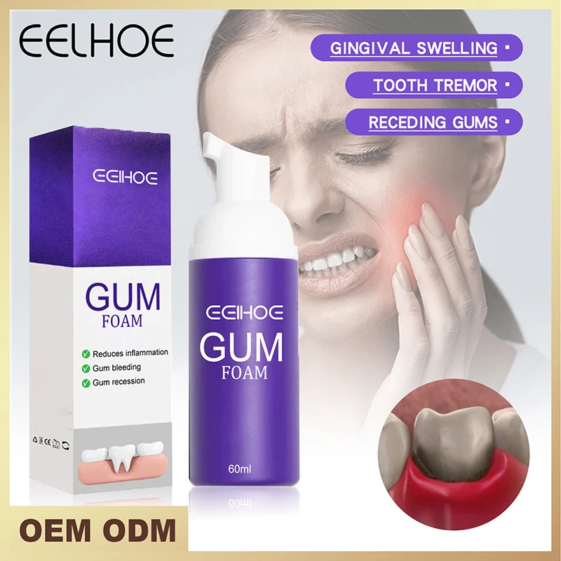 Gomma schiuma Mousse Anti sensibilità sbiancante cura dei denti dentifricio pulisce la bocca rimozione delicata macchie dei denti proteggere le gengive