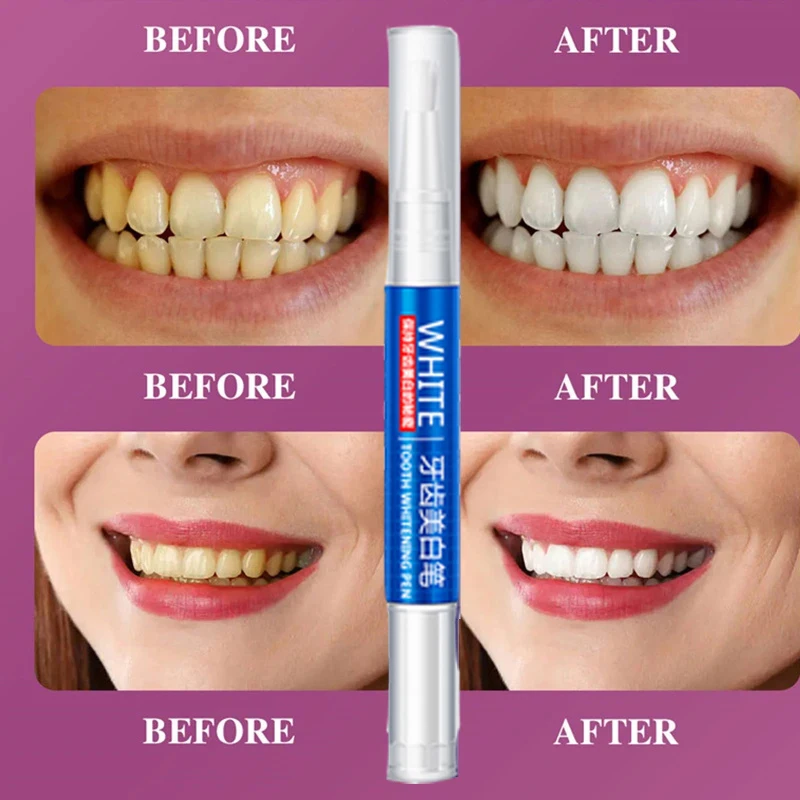 Teeth Whitening Pen Cleaning Pen Beauty Teeth Brightening White Pen Whitening Gel To Remove Yellow Teeth Smoke Teeth Tea Stains