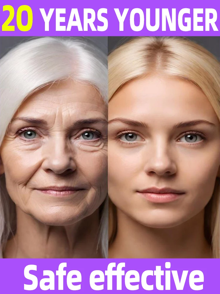 Le rughe scompaiono Diventa bella ora