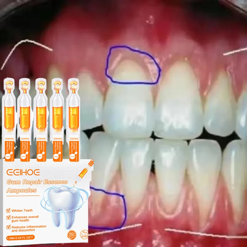 Gum Repair Serum Drops Relieve Receding Gum Periodontal Yellow Treatment Pharyngitis Oral Pain Cleaning Antibacteria Teeth Care