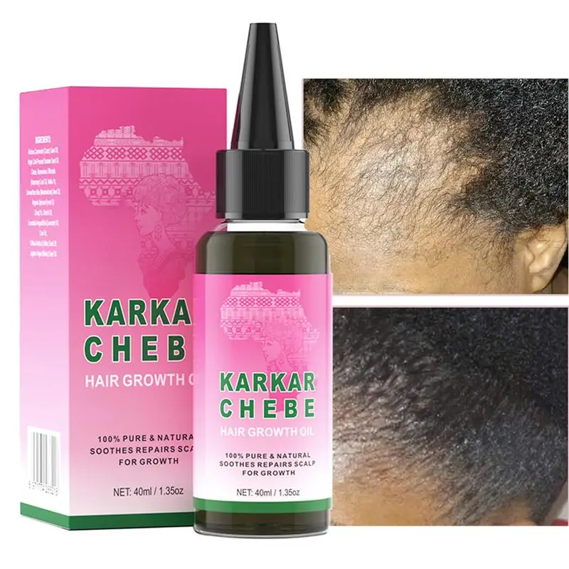 Hair Growth Boost Oil Karkar Oil Anti Hair Loss Oil Rosemary Hair Repair Essence Rosemary Hair Essentiall Oil Hair Conditioner