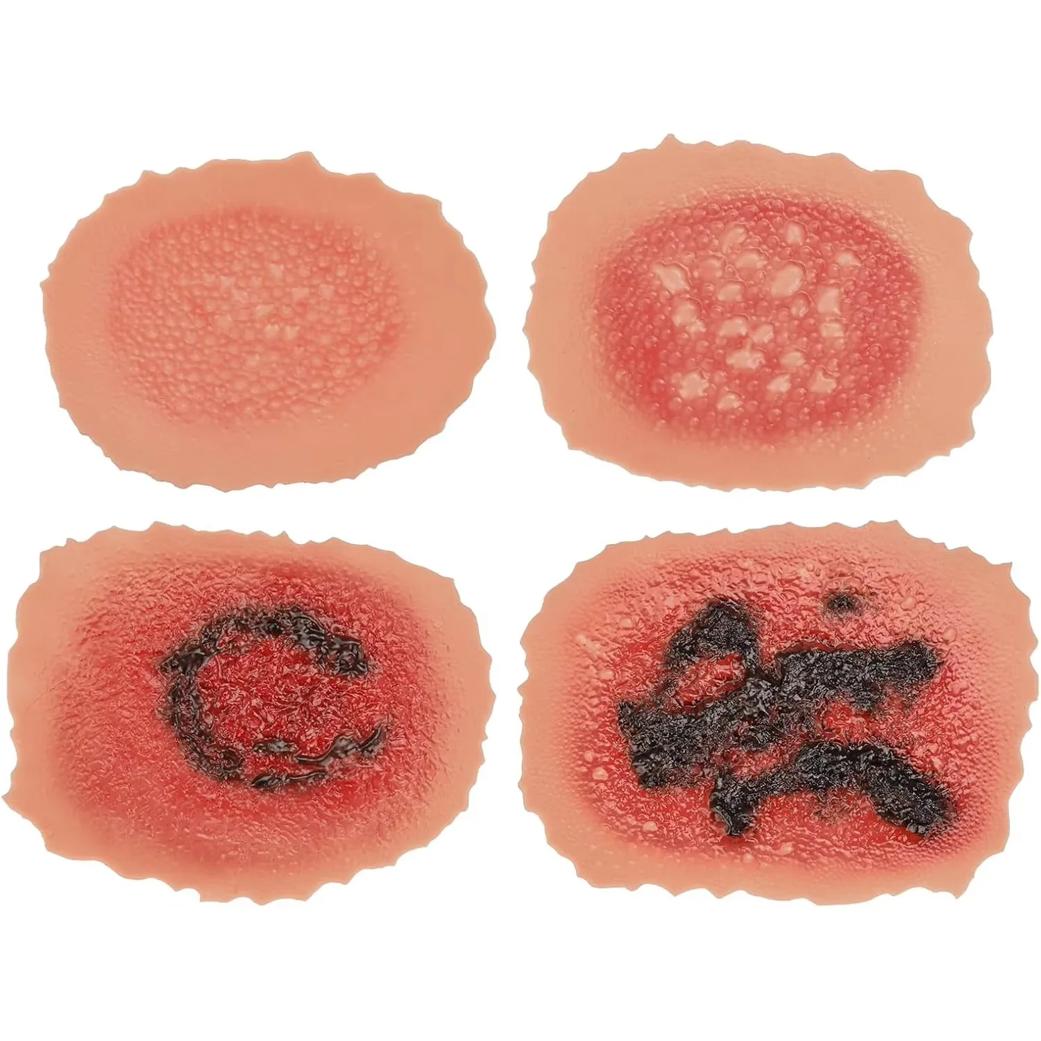 Adhesive Burn Wound Model Set First to Fourth Degree Wound Care Packing Training for First Aid Medical Student Educate Practice