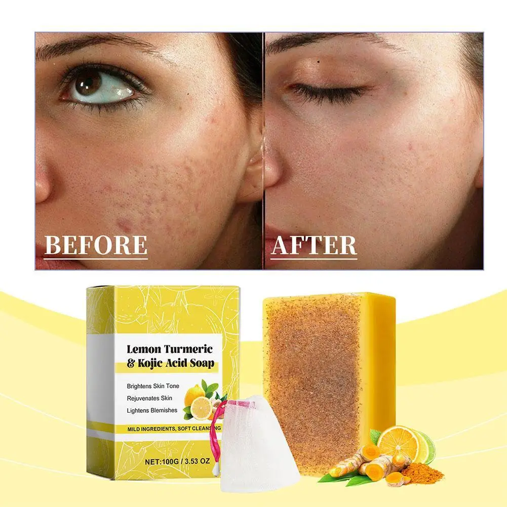 Lemon Turmeric Kojic Acid Soap Deep Cleansing Hydrating Lighten Acne Marks Remove Dullness Face Body Skin Care 100g