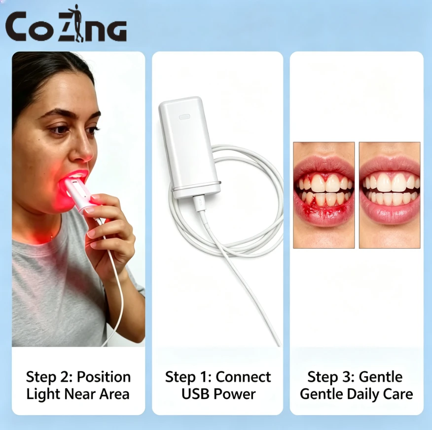 Professional Red Light Therapy Device for Oral Health – Gum Inflammation Relief, Sensitivity & Dental Care Improvement