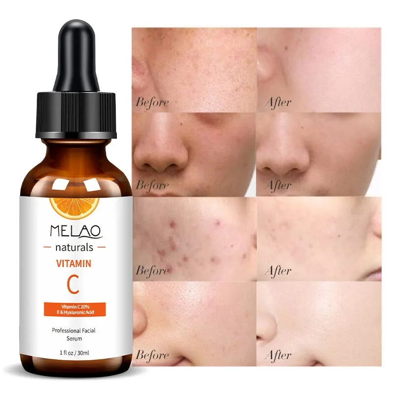 MELAO Vitamin C Facial Serum Anti Aging Whitening Brightening Dark Spots Freckle Remove Hyaluronic Acid Vitamin E 30ML