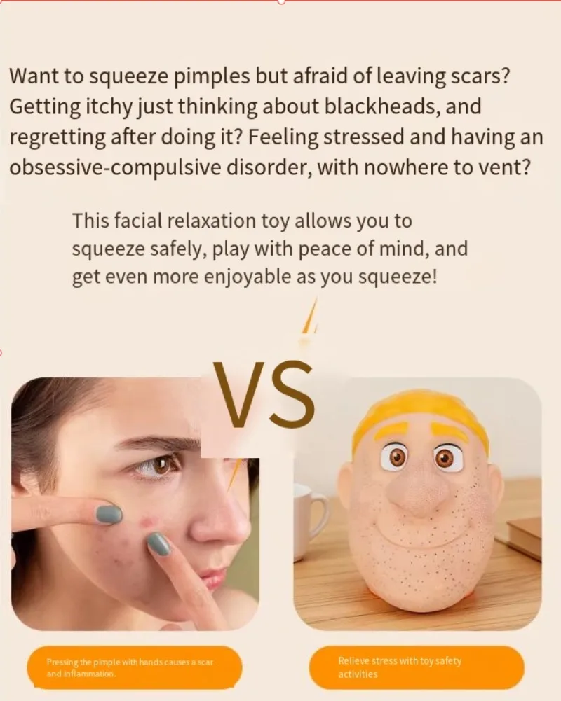 Pimple Popper Fidget Toy, Realistic Face Model, Blackhead Squeeze Tool, ASMR Toy for OCD, Acne‑Squeezing for Anxiety Relief