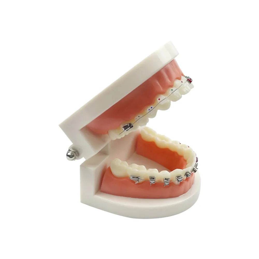 Model ortodontyczny z samodzielnym wspornikiem metalowym Aparat ceramiczny Typodont Stomatologia Zęby Nauczanie Studium Produkty demonstracyjne