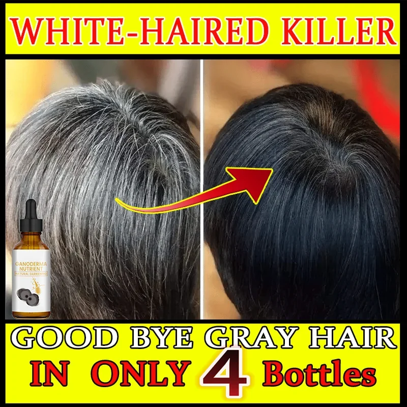 

White hair killer, remove gray hair and restore natural hair color in 7 days Healthy,quickly turns white airh into black