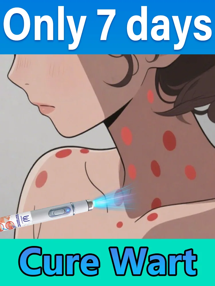 Generation-2 Laser Says Goodbye To Wart Remove Quickly