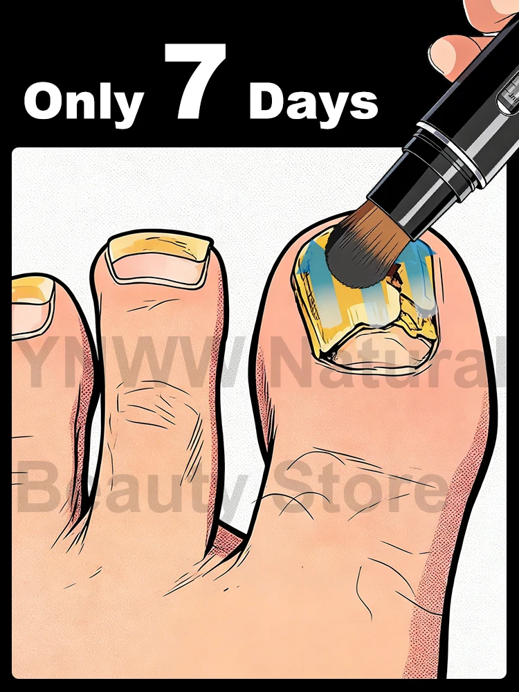 

Новая массажная щетка 2026 года, улучшает впитывание, укрепляет ногти, бесплатная доставка, хит продаж!