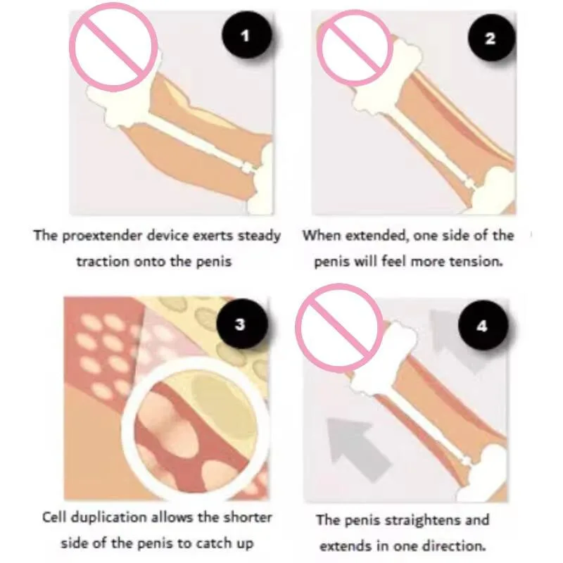 Men's Penis Enlargement System Male Massage Kit with Growth Bracket Extender Stretcher for Enhanced Sexual Performance view 6